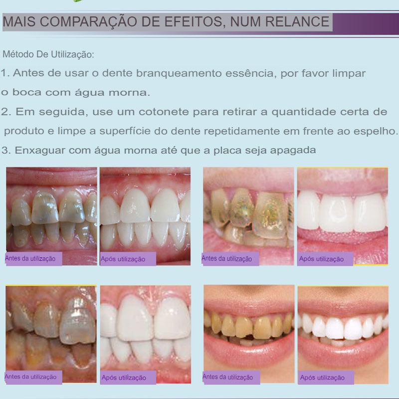 Clareador Dental RtopR - DUKSTORAGE